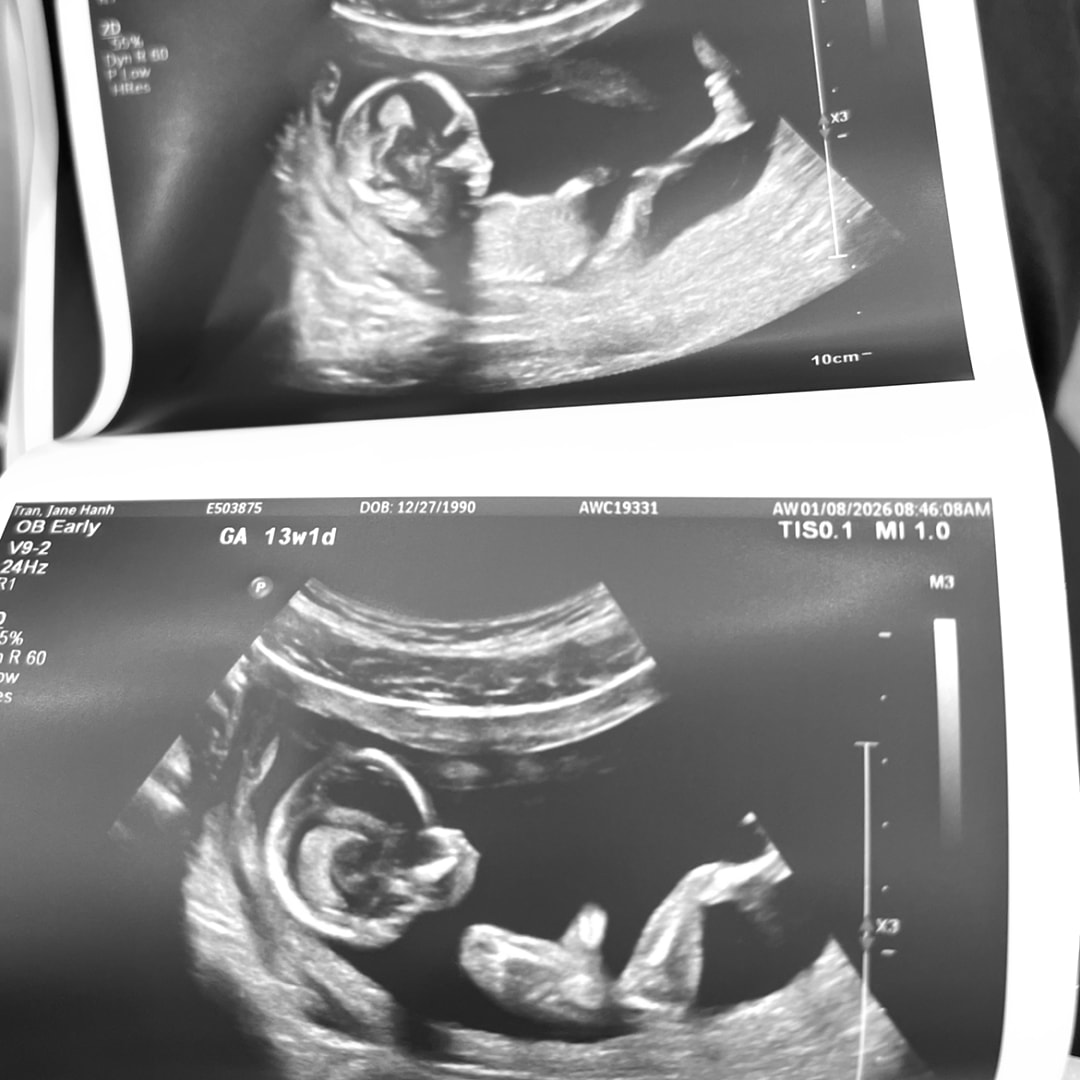 Photo shared by Jane for their Babylist baby registry.