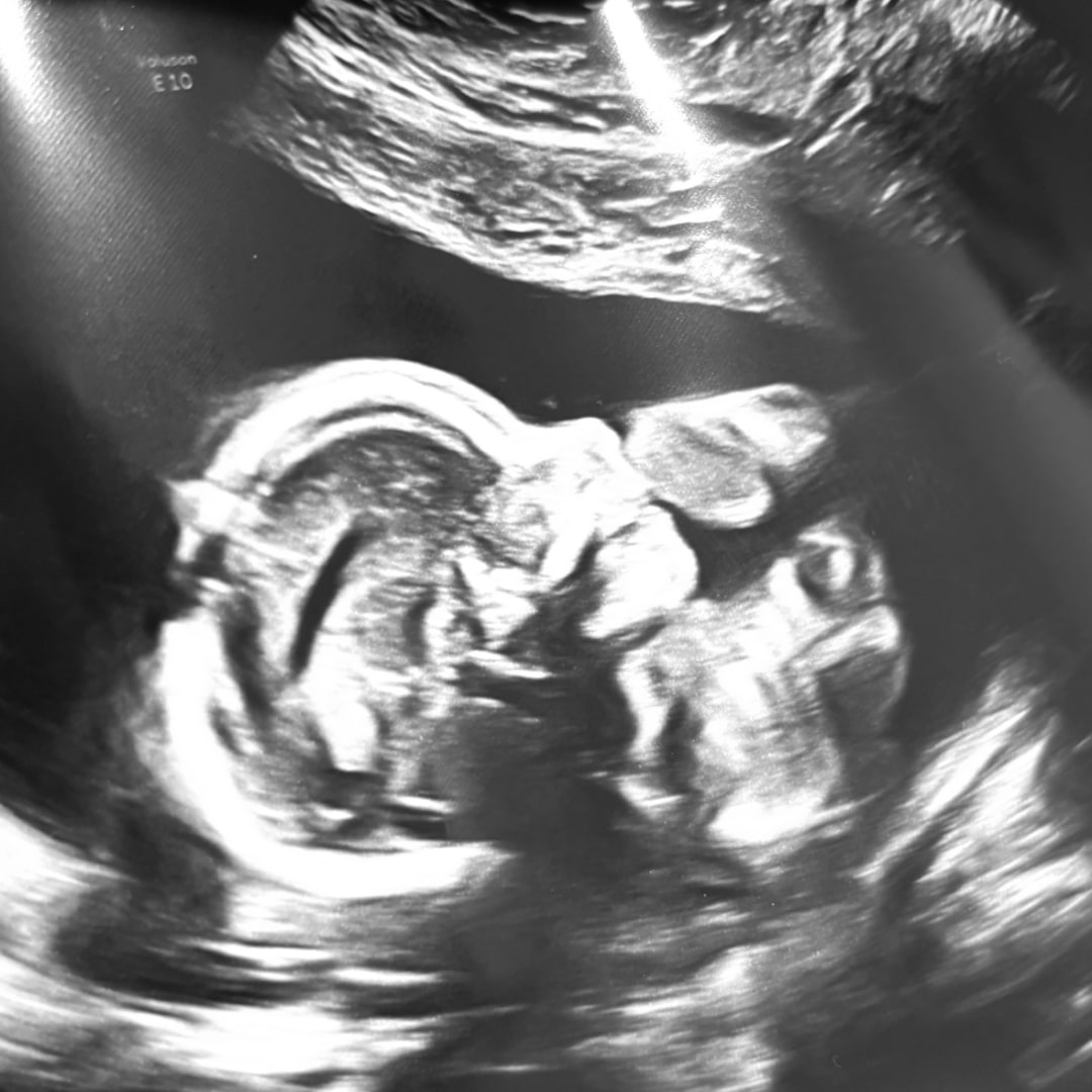Photo shared by Chelsea for their Babylist baby registry.