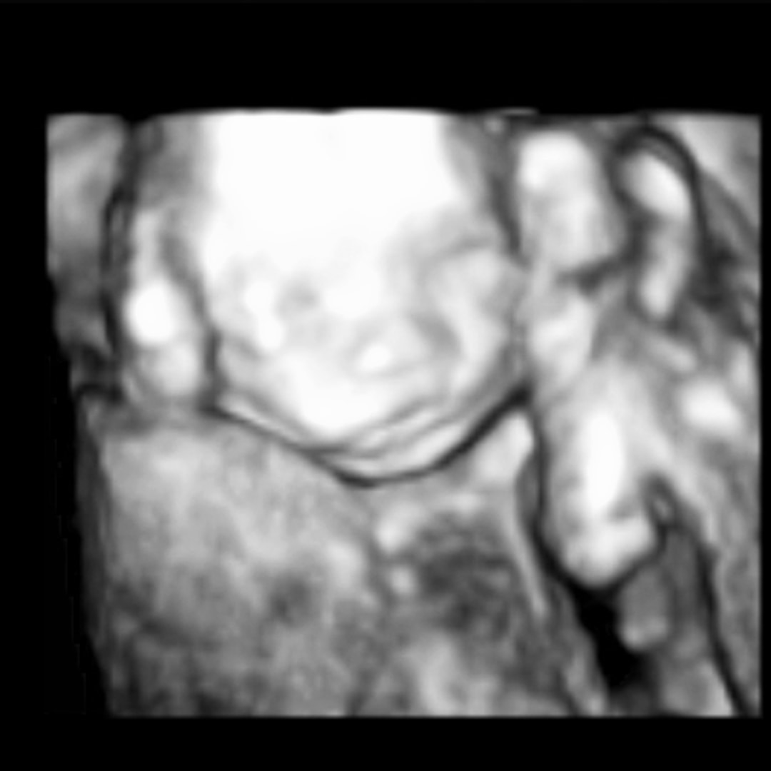 Photo shared by Rebekah for their Babylist baby registry.