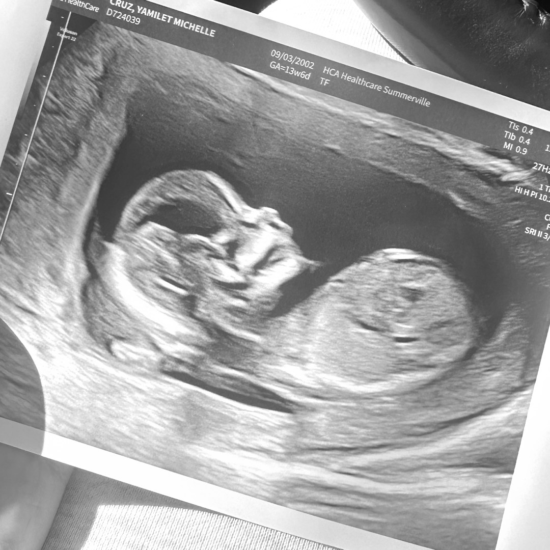 Photo shared by Yamilet for their Babylist baby registry.