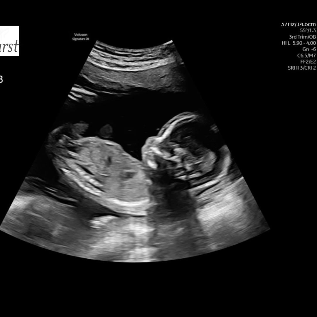 Photo shared by Keely for their Babylist baby registry.