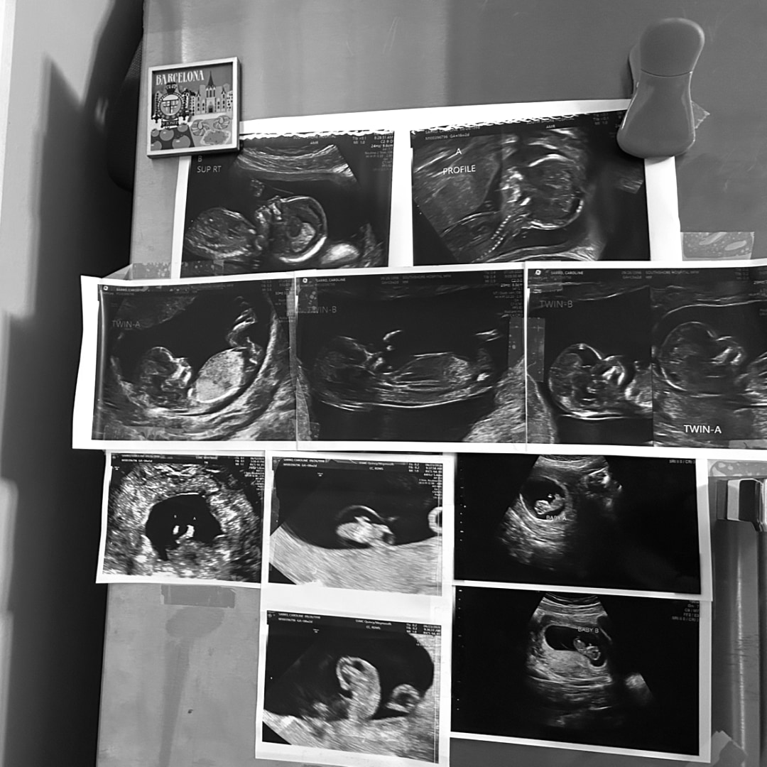 Photo shared by Caroline for their Babylist baby registry.