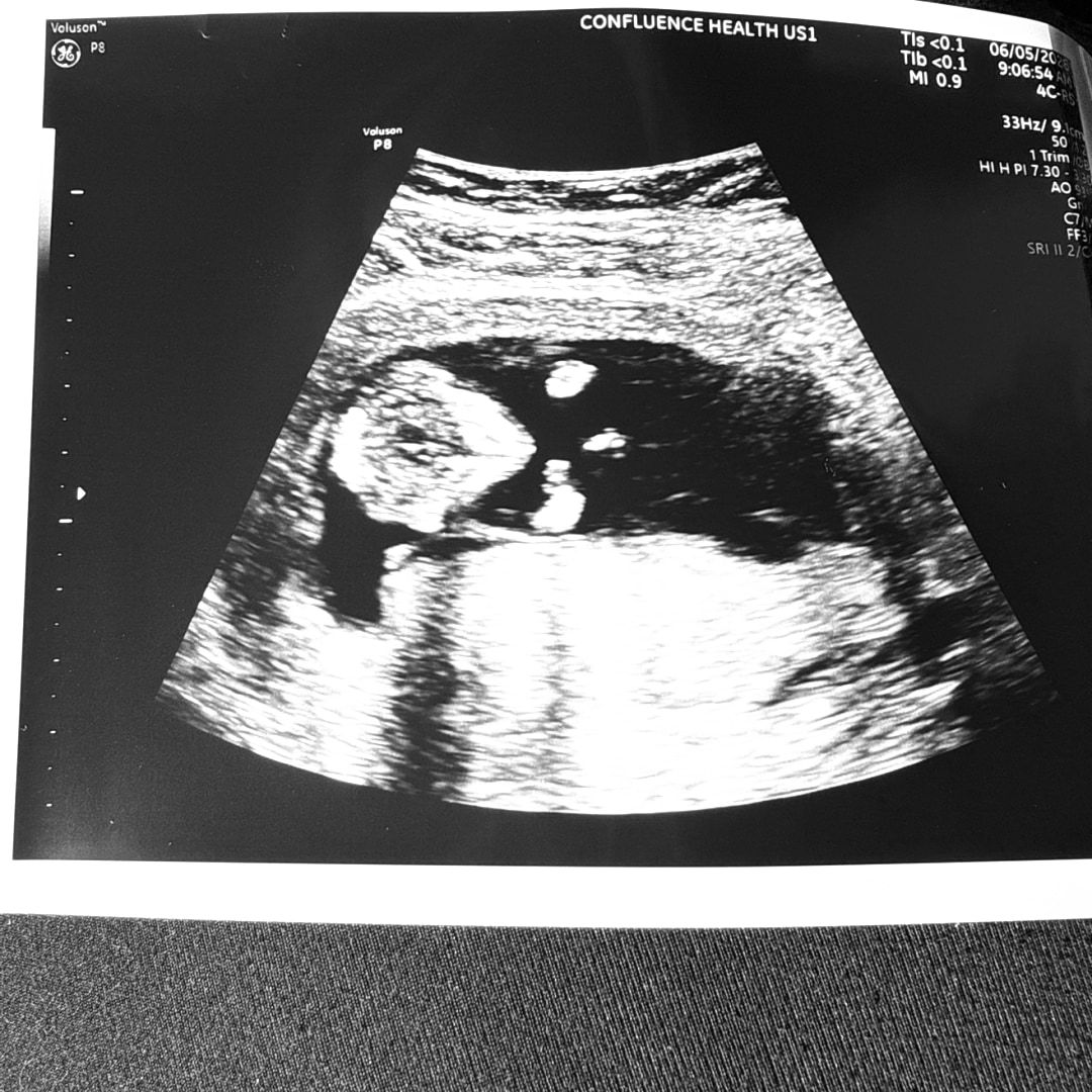 Photo shared by Jenissa for their Babylist baby registry.