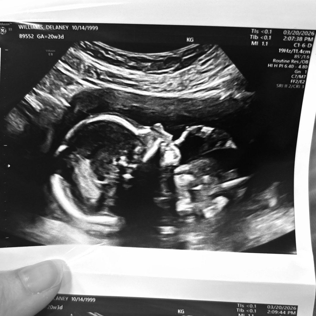 Photo shared by Delaney for their Babylist baby registry.