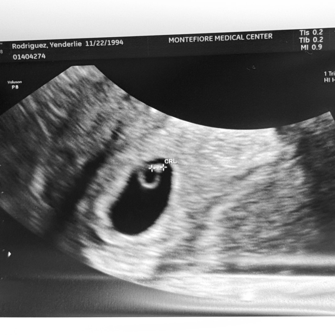 Photo shared by Yenderlie for their Babylist baby registry.