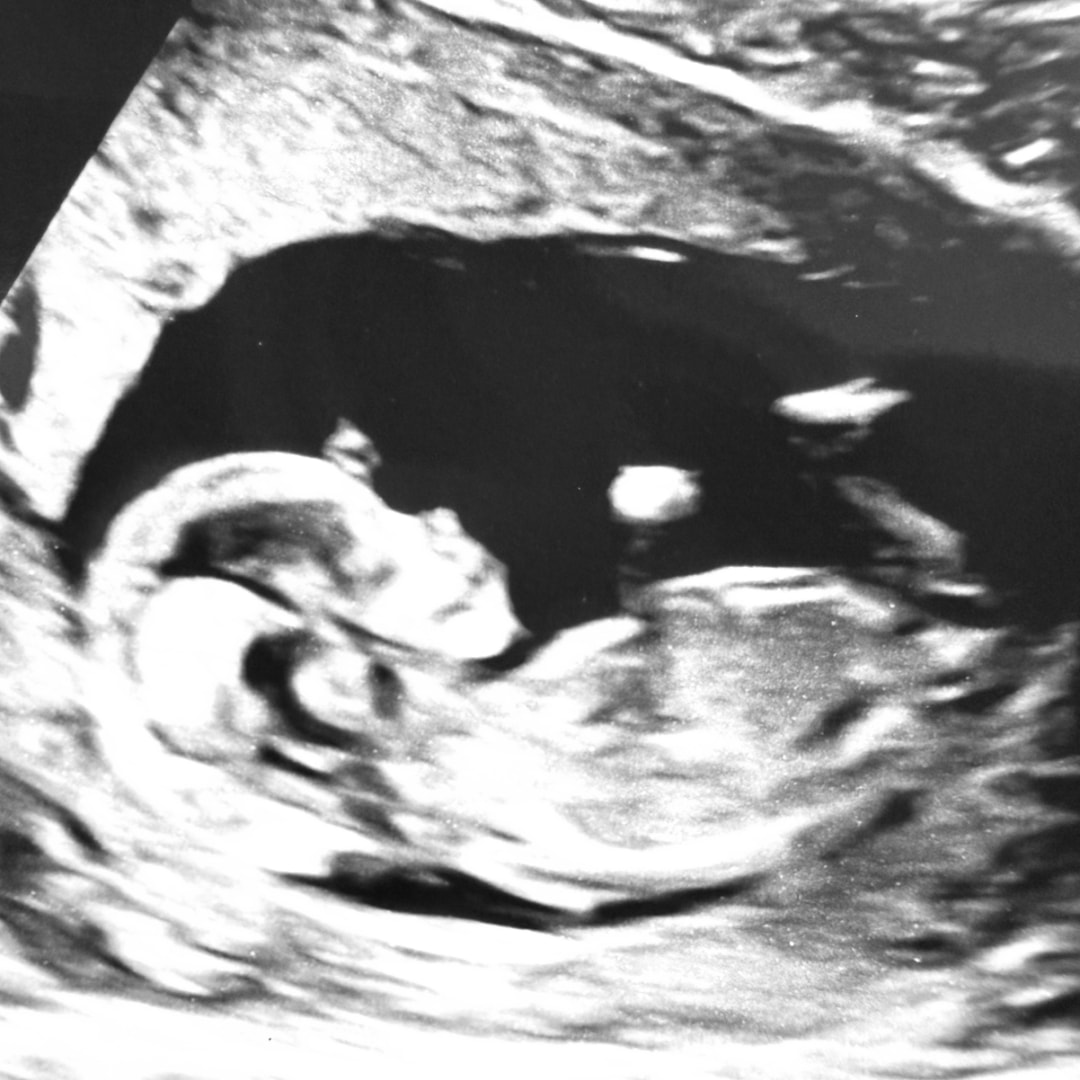 Photo shared by Charmaine for their Babylist baby registry.
