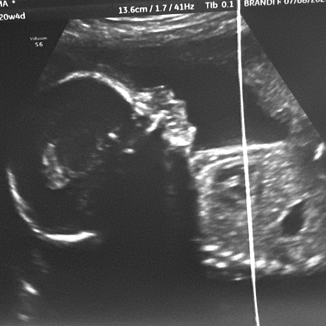 Photo shared by Emma for their Babylist baby registry.