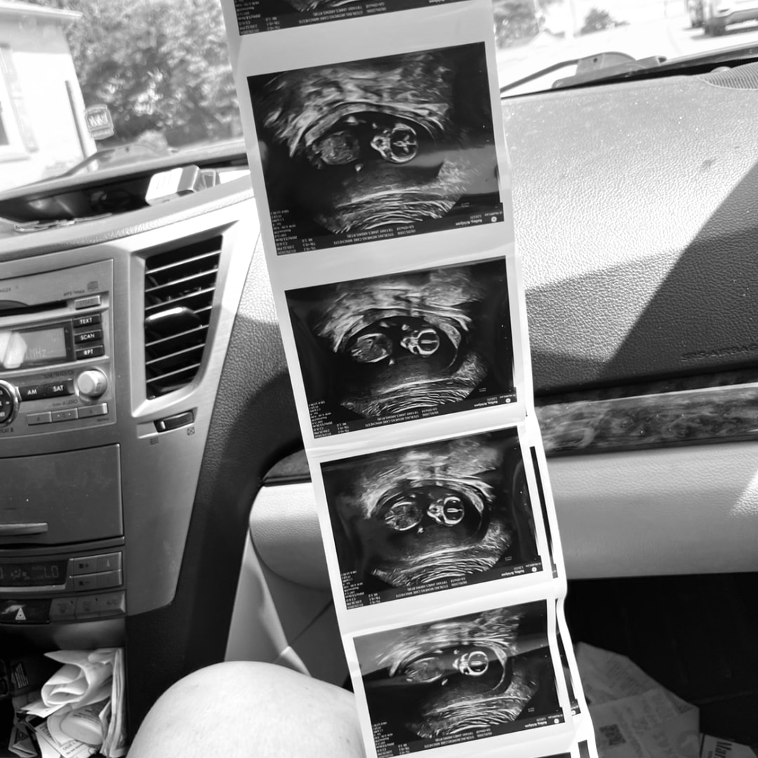 Photo shared by Krislynn for their Babylist baby registry.