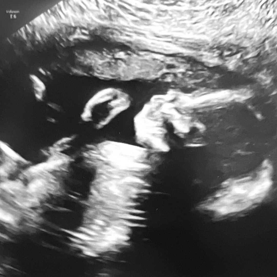 Photo shared by Christina for their Babylist baby registry.