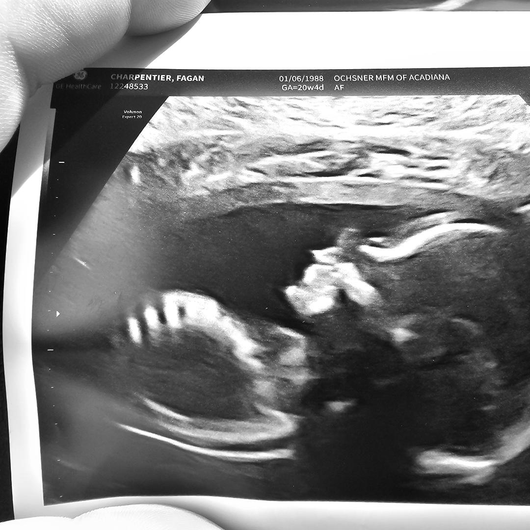 Photo shared by Fagan for their Babylist baby registry.