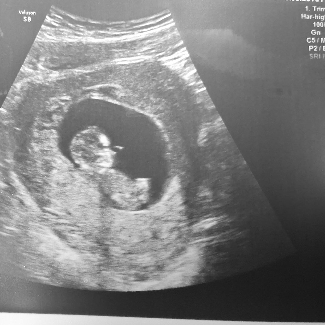 Photo shared by Anna for their Babylist baby registry.
