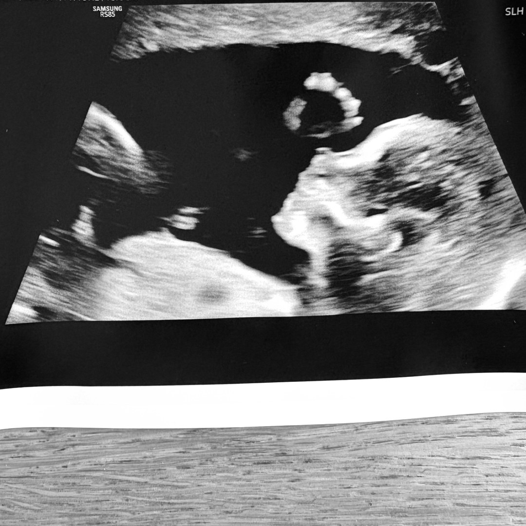Photo shared by Sarah for their Babylist baby registry.