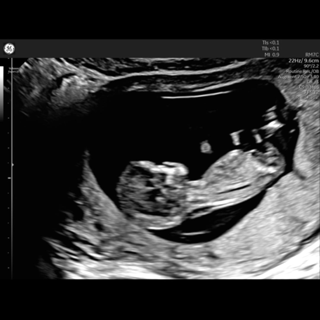 Photo shared by Angelique for their Babylist baby registry.