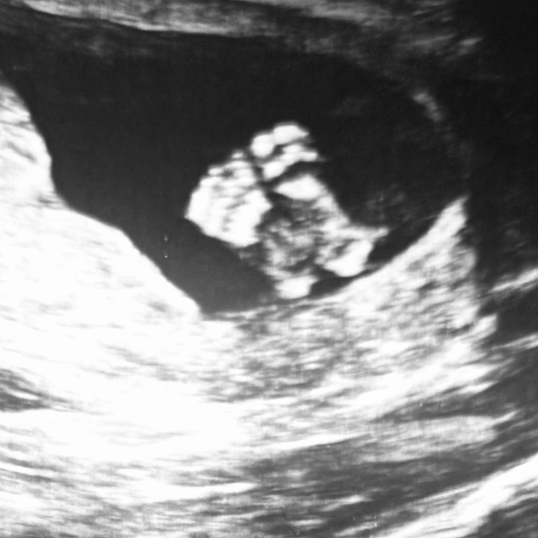 Photo shared by Payton for their Babylist baby registry.