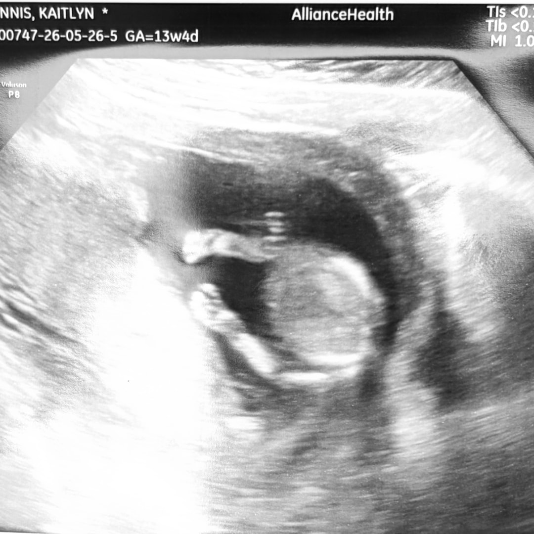 Photo shared by Kaitlyn for their Babylist baby registry.