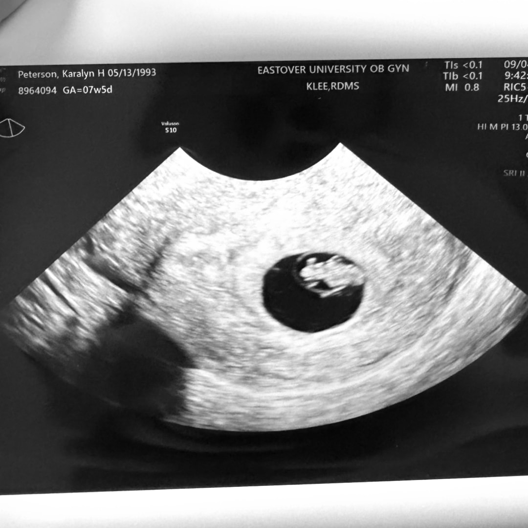 Photo shared by Karalyn for their Babylist baby registry.