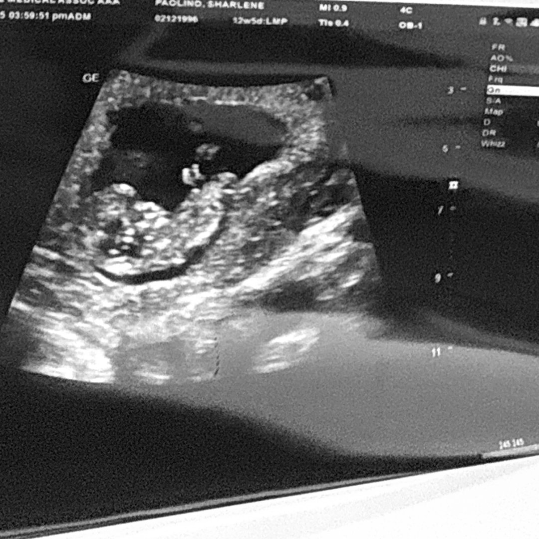 Photo shared by Sharlene for their Babylist baby registry.