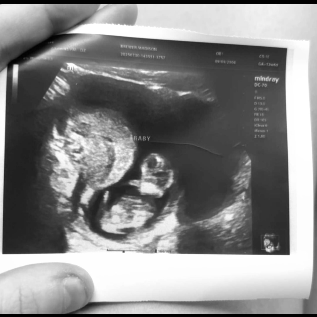 Photo shared by Maddy for their Babylist baby registry.