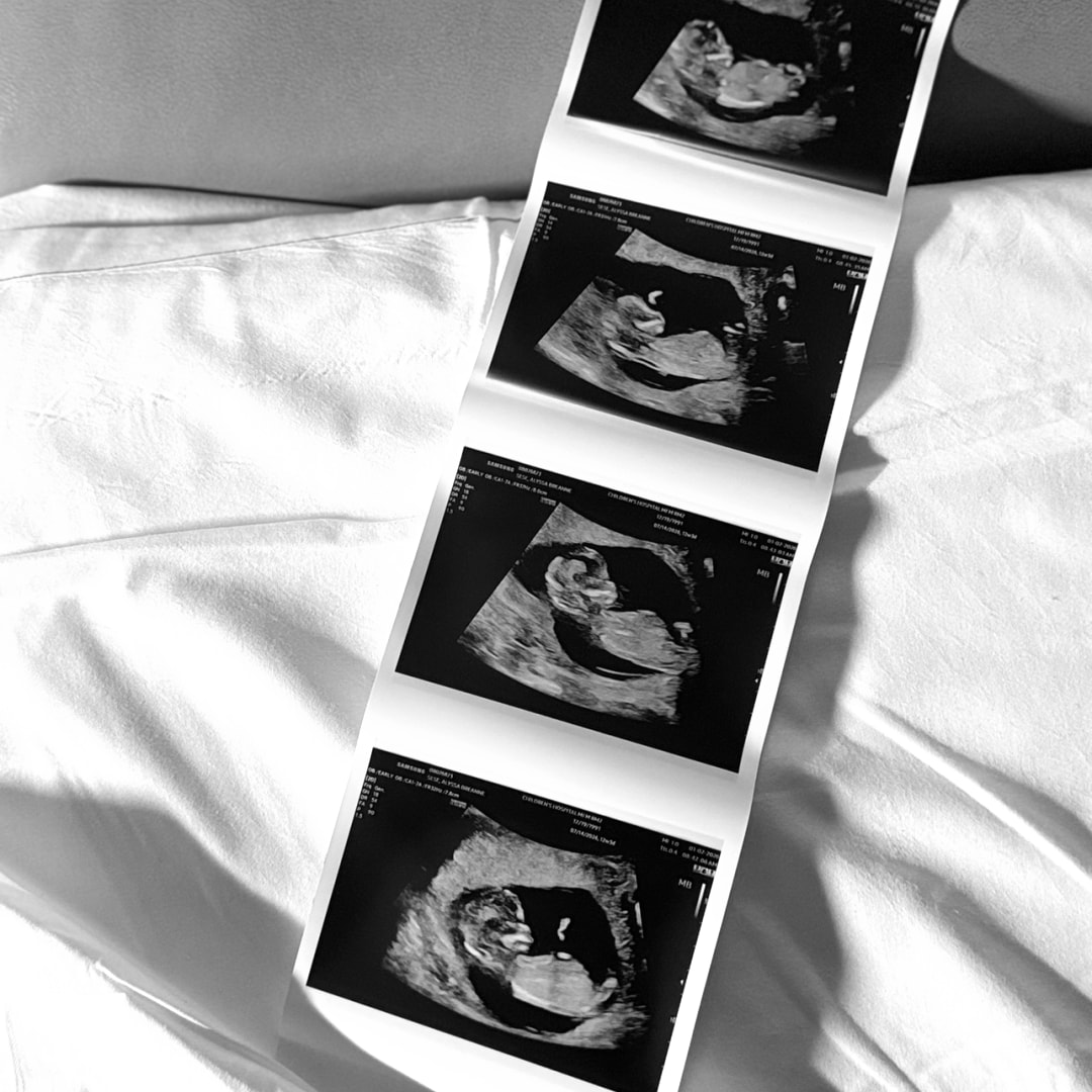 Photo shared by Aly for their Babylist baby registry.