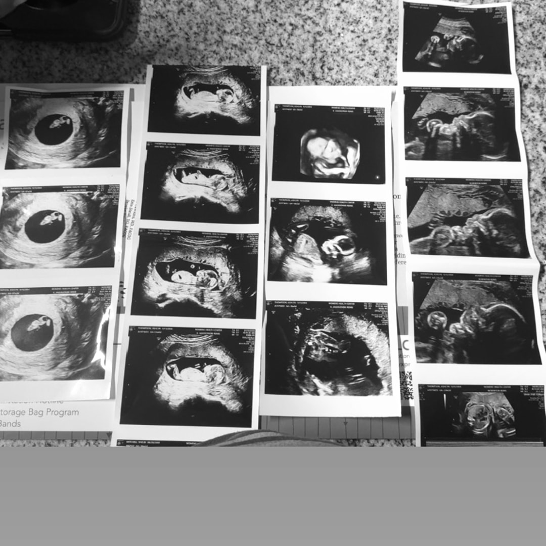Photo shared by Ashlyn for their Babylist baby registry.