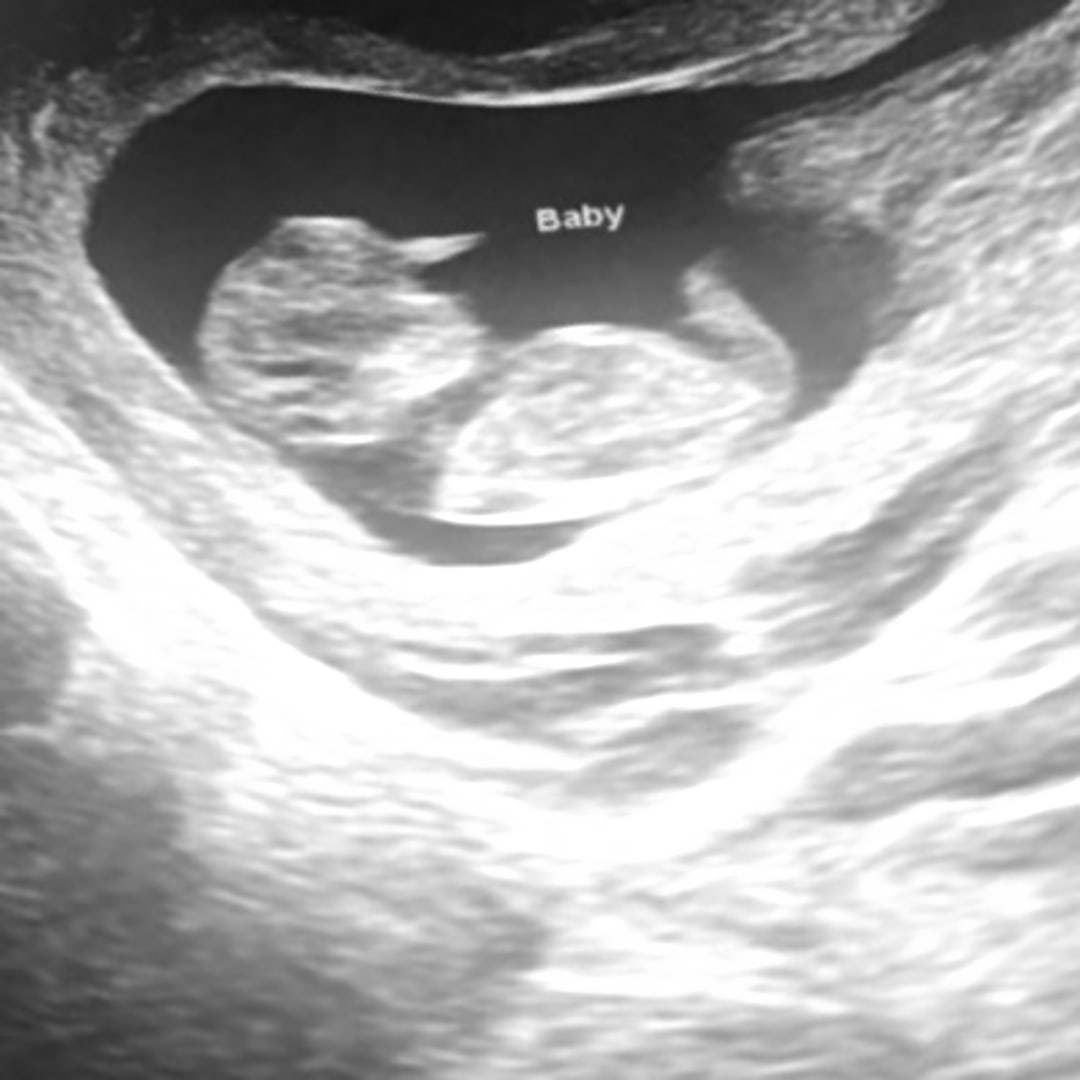 Photo shared by Amyauah for their Babylist baby registry.