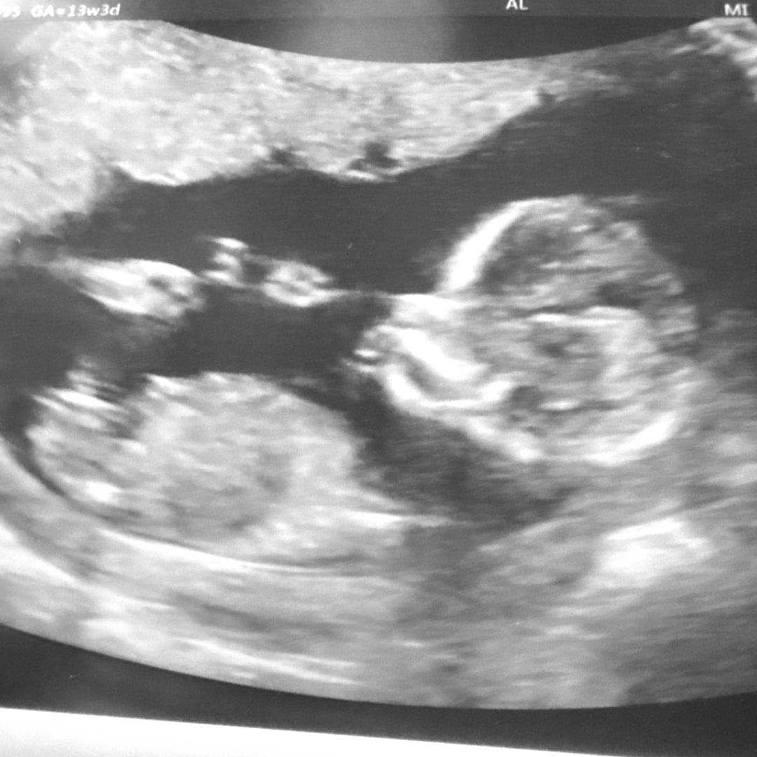 Photo shared by Caroline for their Babylist baby registry.