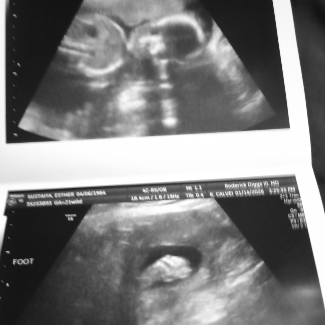 Photo shared by Esther for their Babylist baby registry.