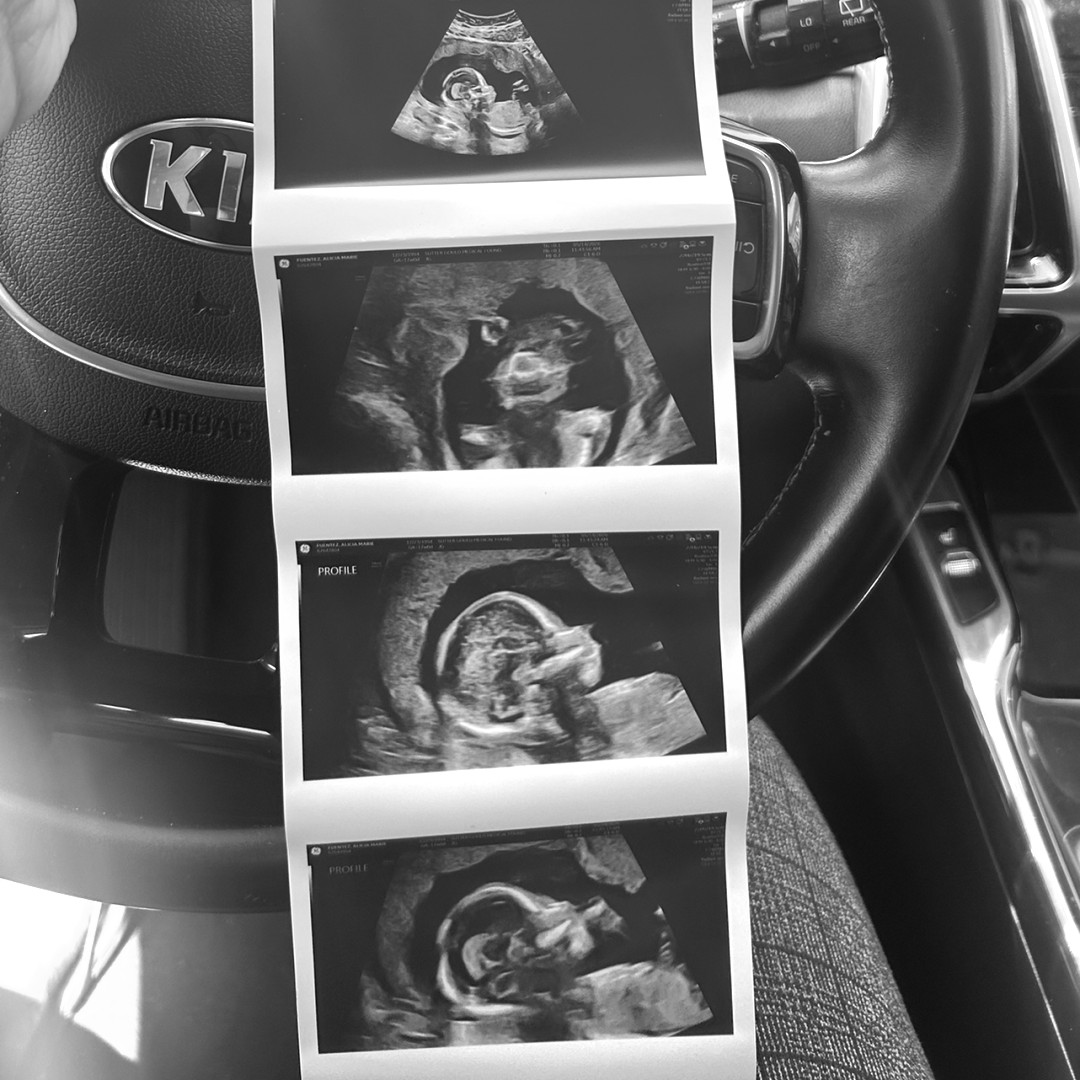 Photo shared by Alicia for their Babylist baby registry.