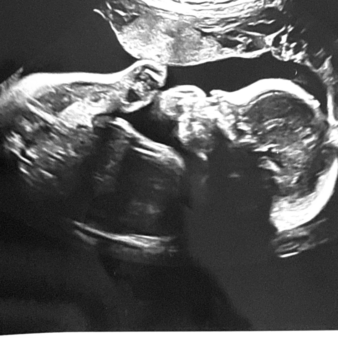 Photo shared by Ashley for their Babylist baby registry.
