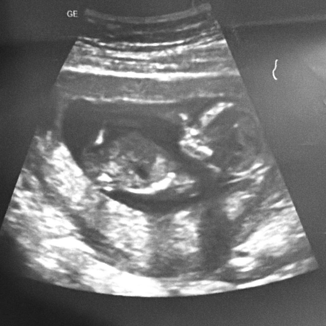 Photo shared by Jessica for their Babylist baby registry.