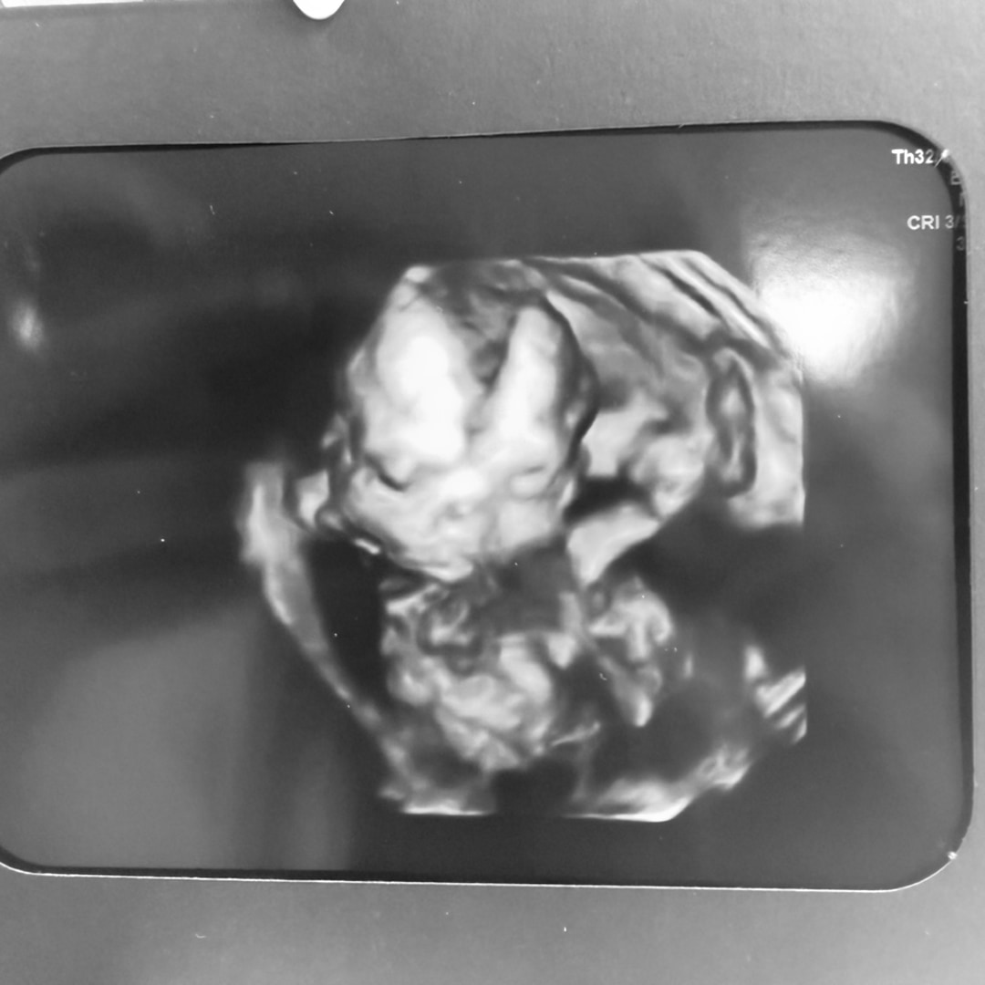 Photo shared by Haley for their Babylist baby registry.