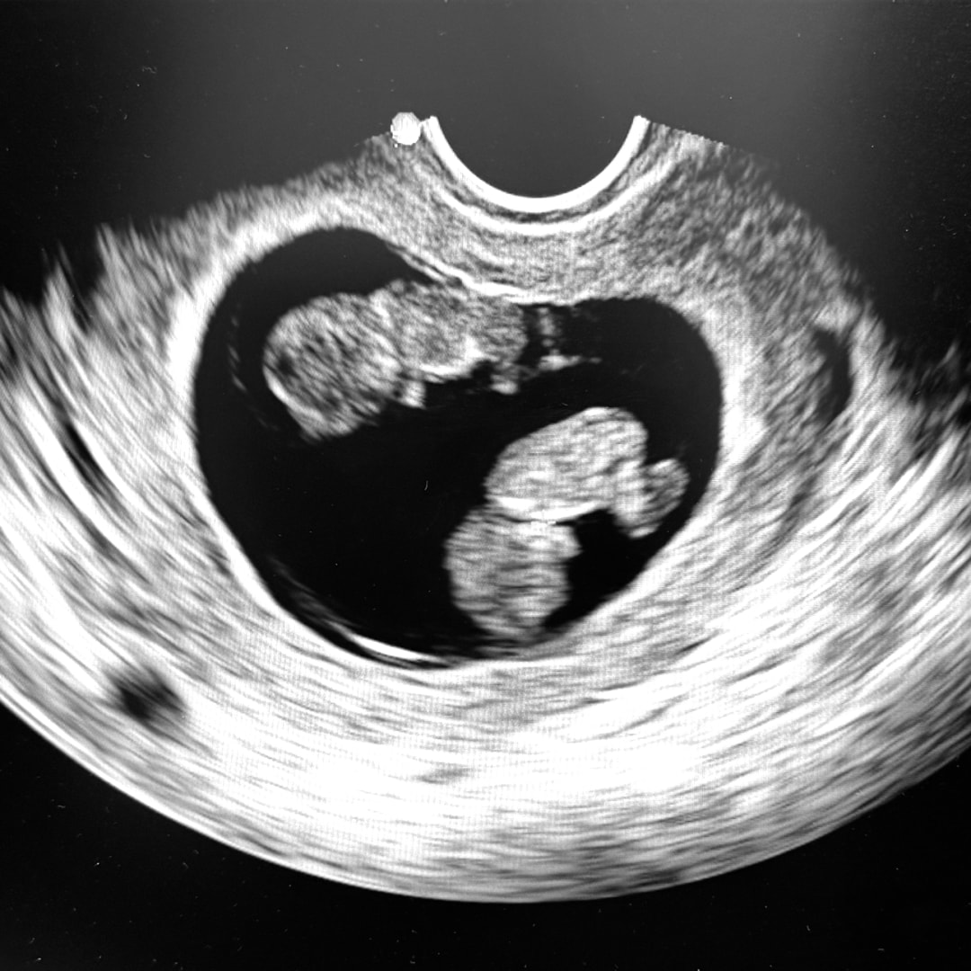 Photo shared by Betty for their Babylist baby registry.