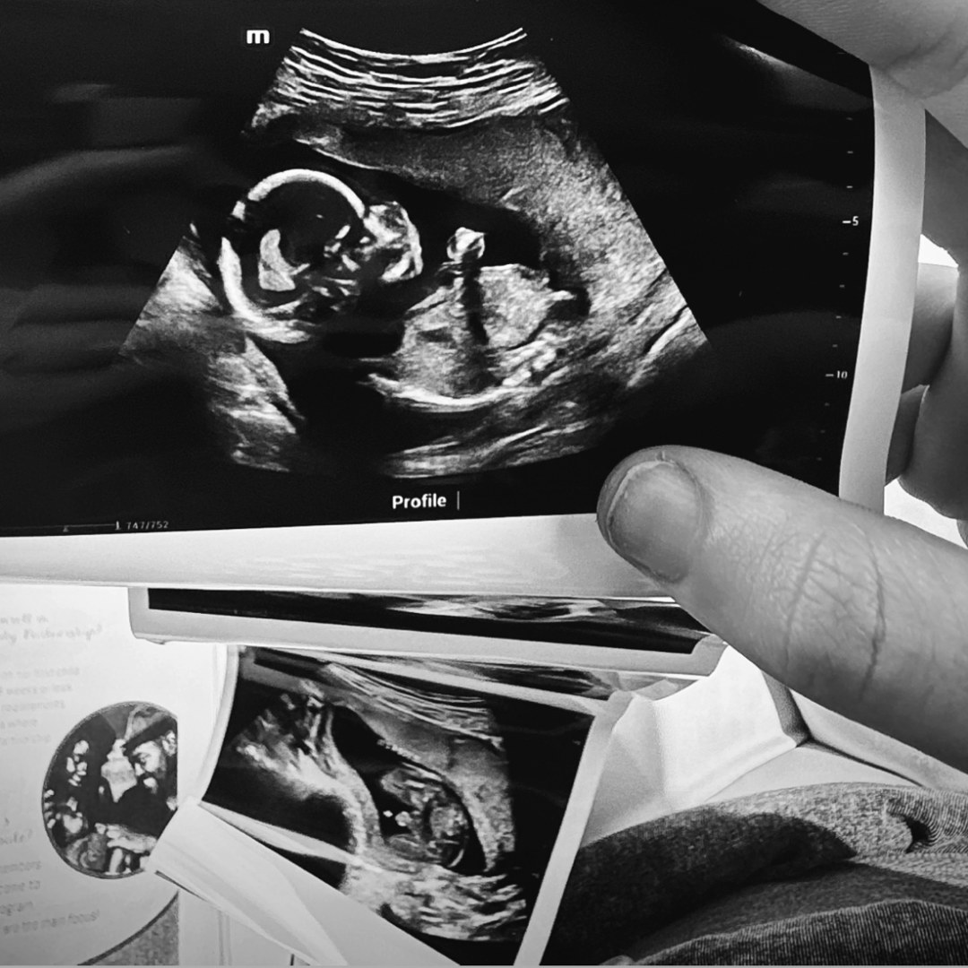 Photo shared by Addison for their Babylist baby registry.
