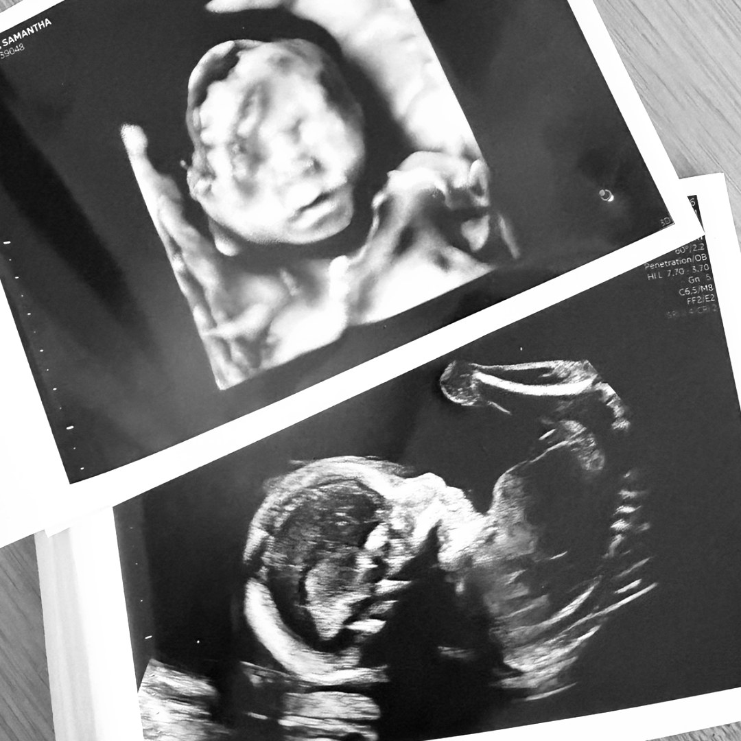 Photo shared by Samantha for their Babylist baby registry.