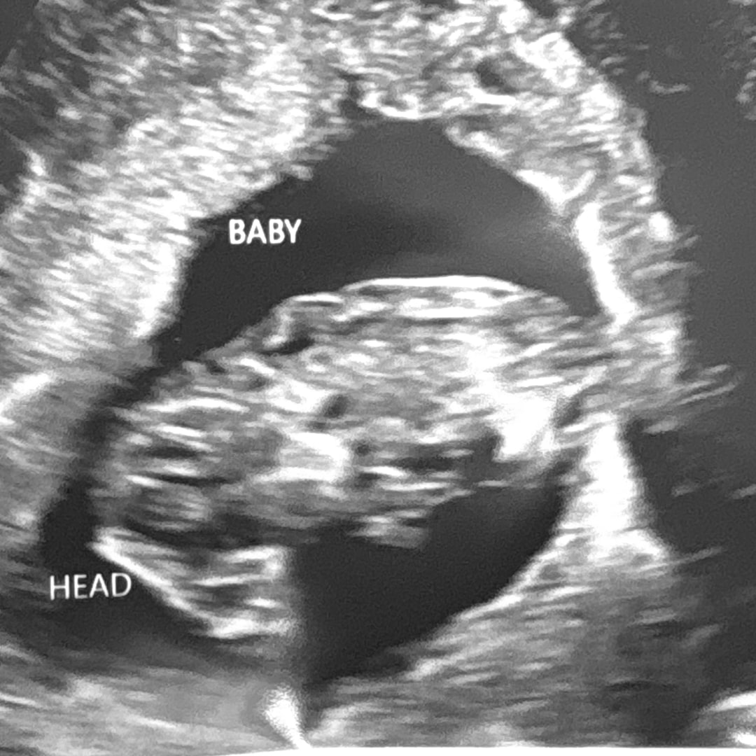 Photo shared by Bre for their Babylist baby registry.