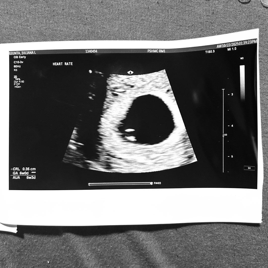 Photo shared by Juliana for their Babylist baby registry.