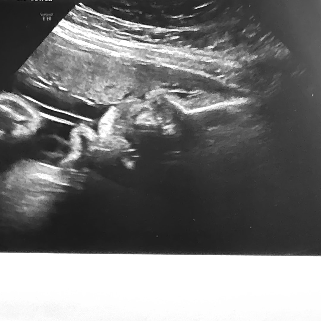 Photo shared by Payton for their Babylist baby registry.