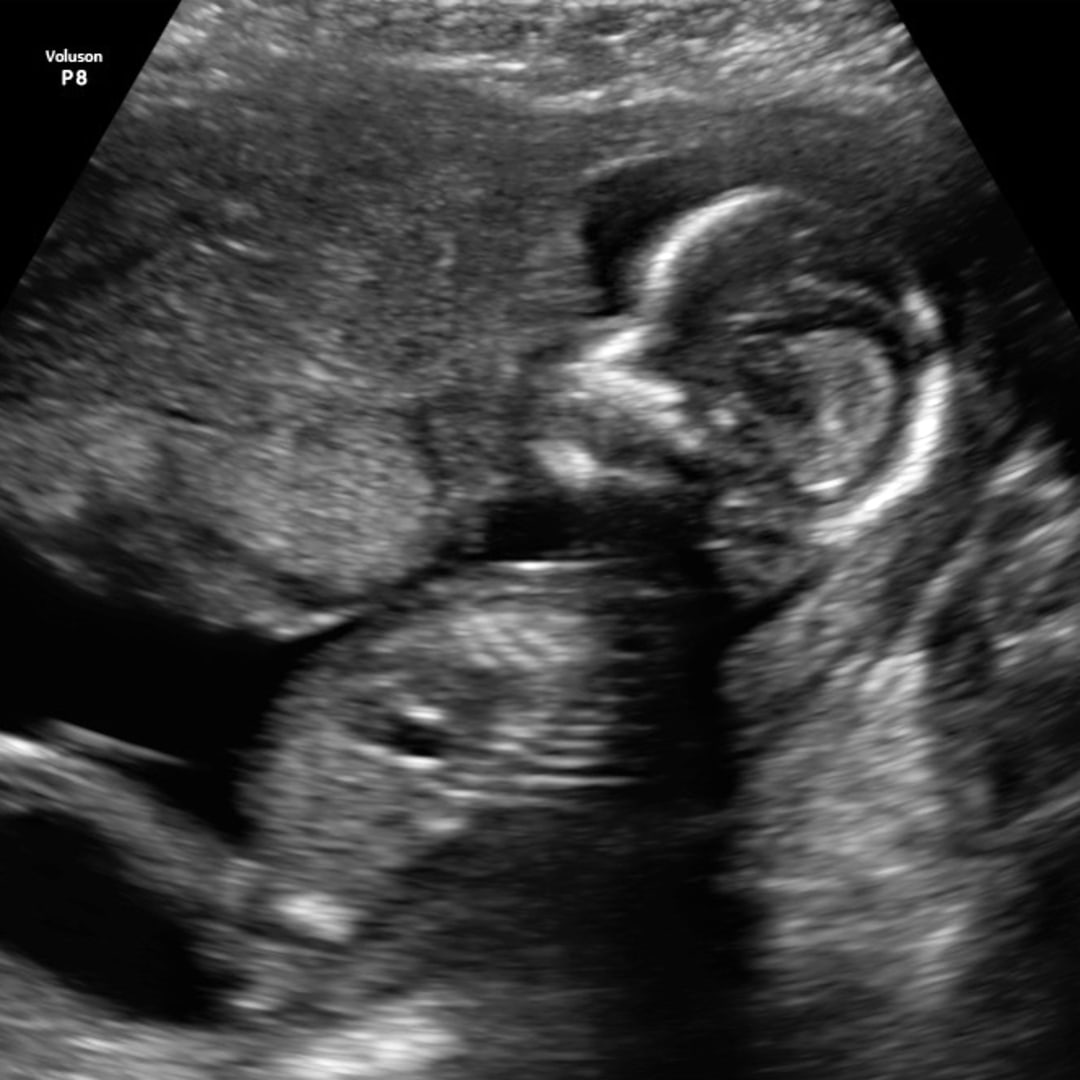 Photo shared by Ashley for their Babylist baby registry.