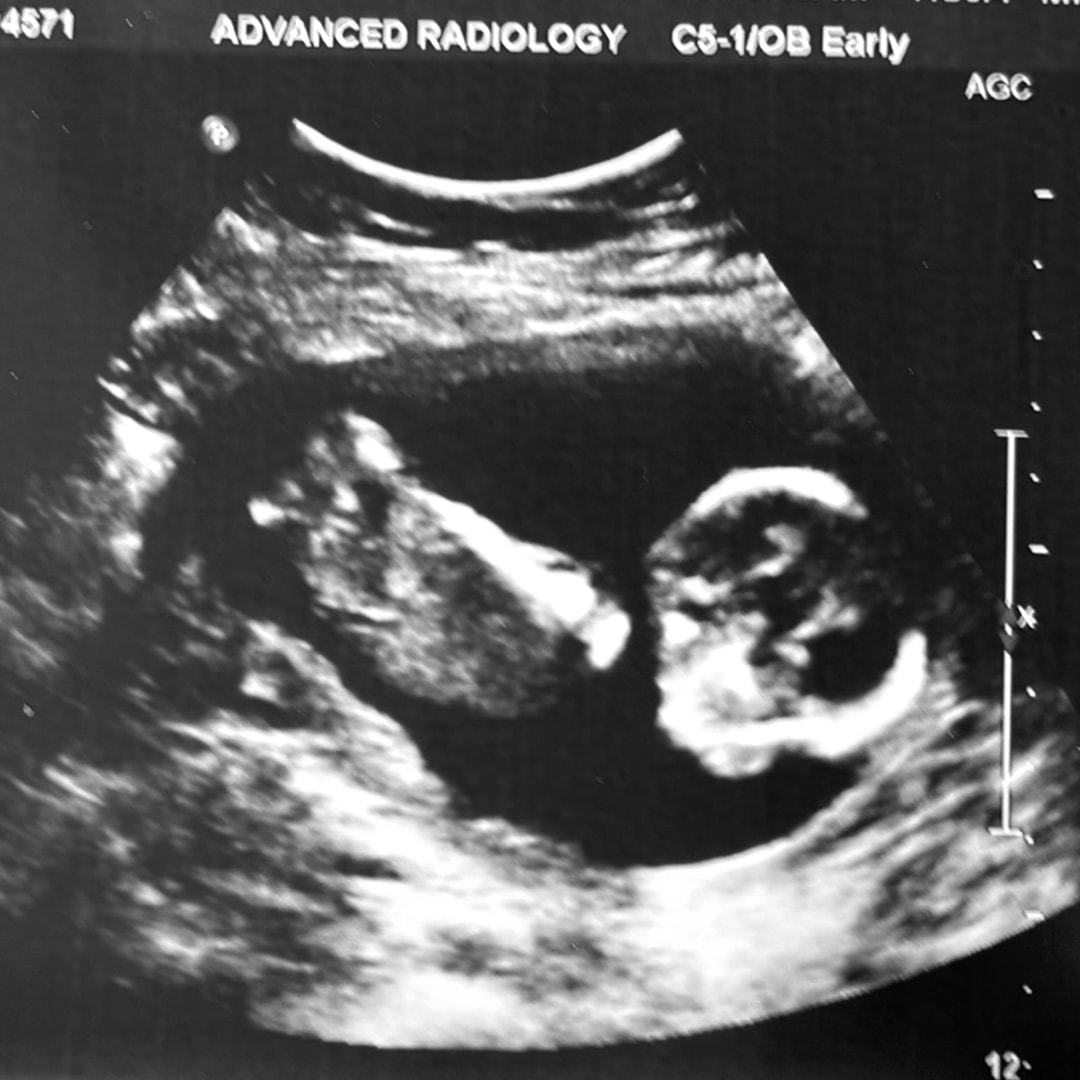Photo shared by Elaine for their Babylist baby registry.