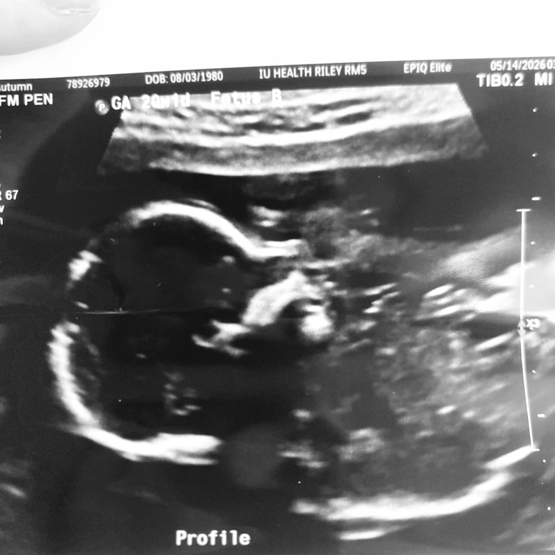 Photo shared by Autumn for their Babylist baby registry.