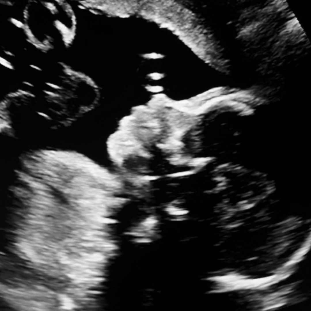 Photo shared by Inez for their Babylist baby registry.