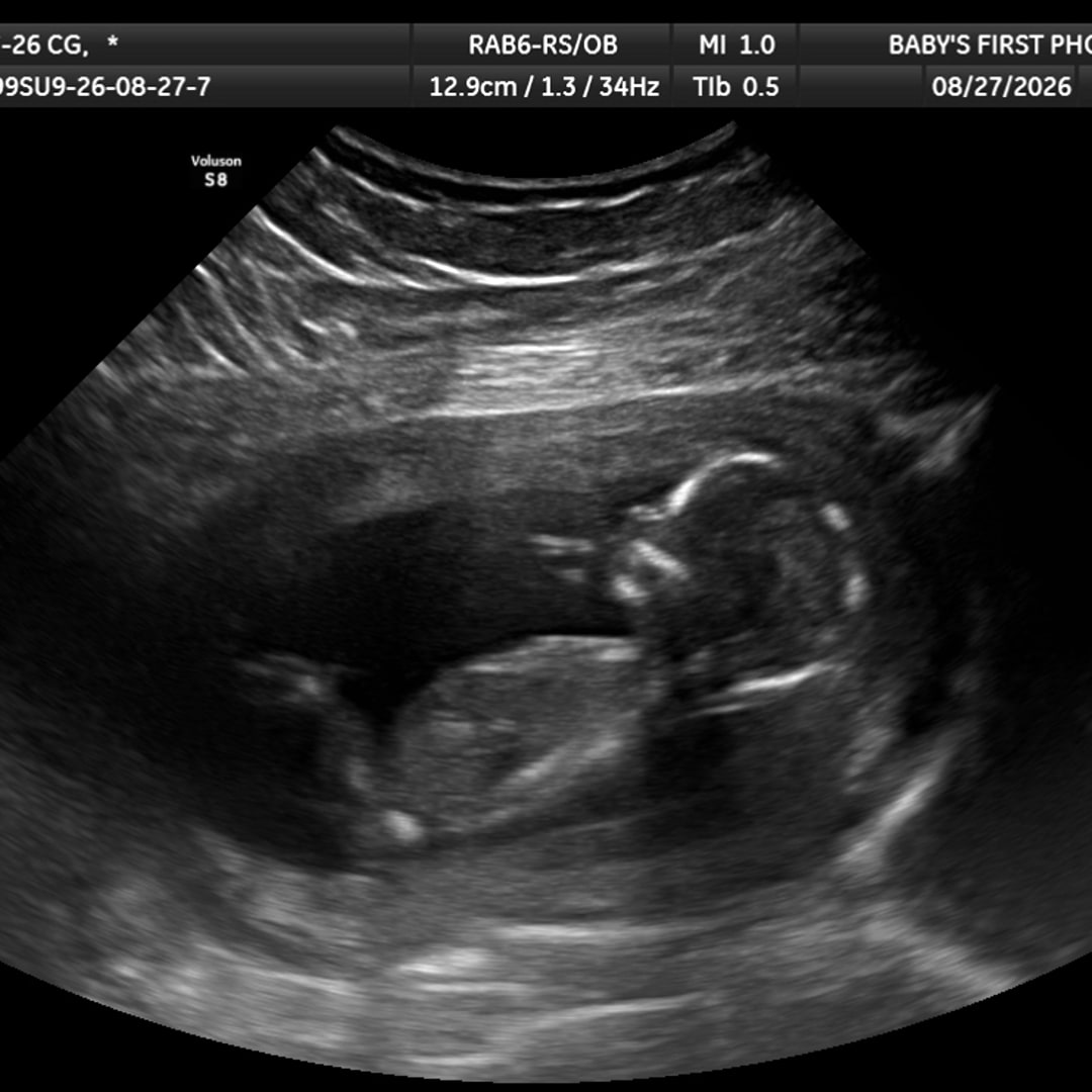 Photo shared by Carina for their Babylist baby registry.