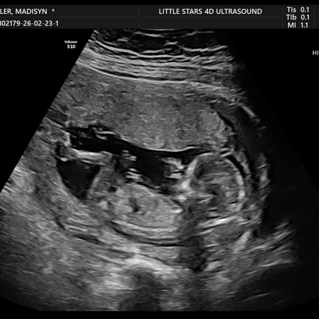 Photo shared by Madisyn for their Babylist baby registry.
