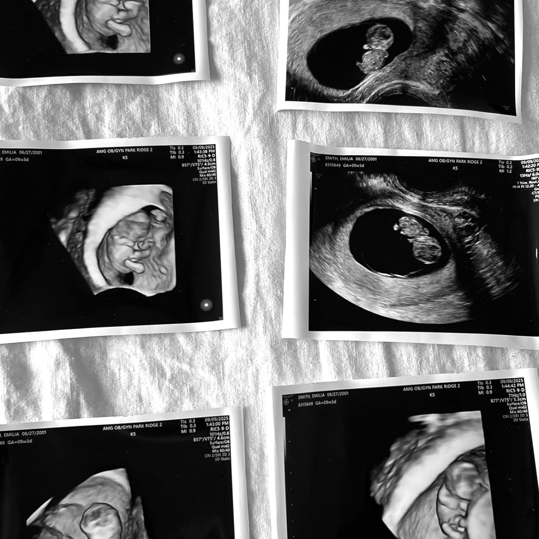 Photo shared by Emma for their Babylist baby registry.