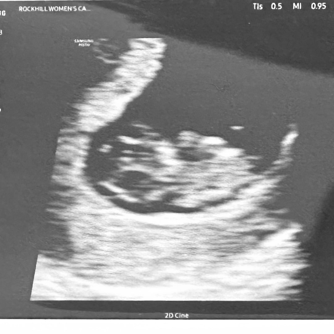 Photo shared by Mikayla for their Babylist baby registry.