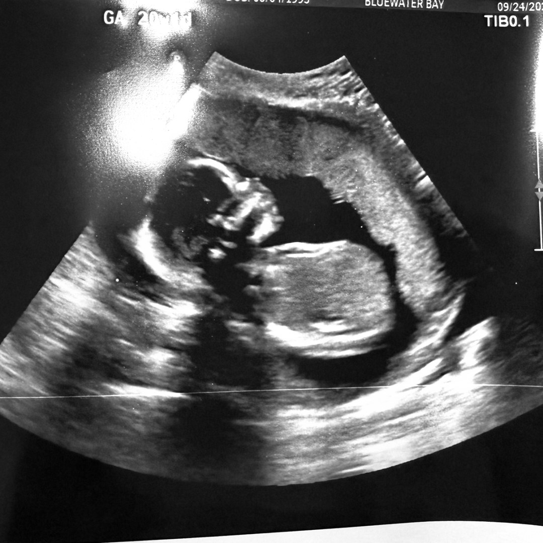 Photo shared by Eyleen for their Babylist baby registry.