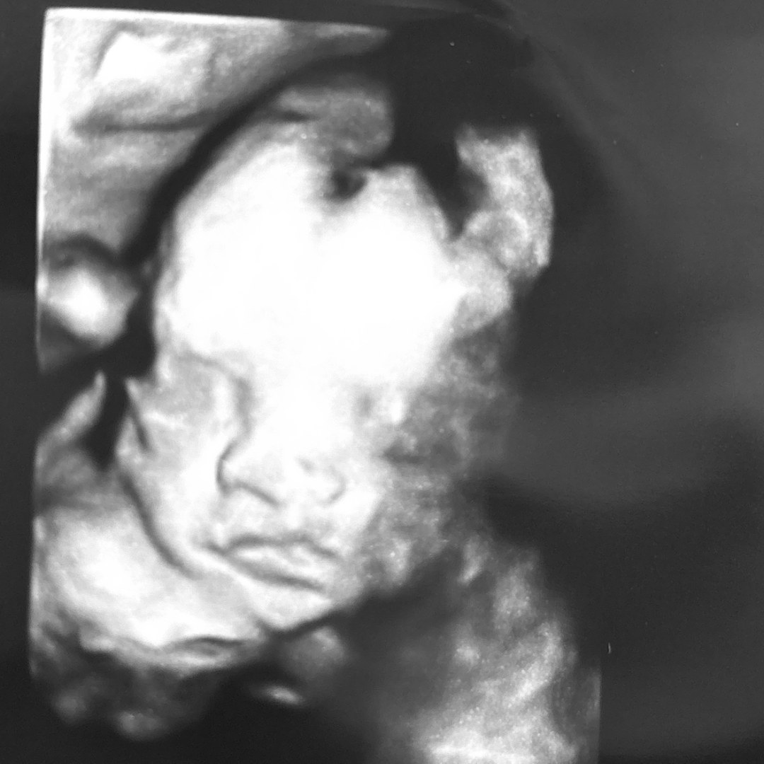 Photo shared by Leah for their Babylist baby registry.