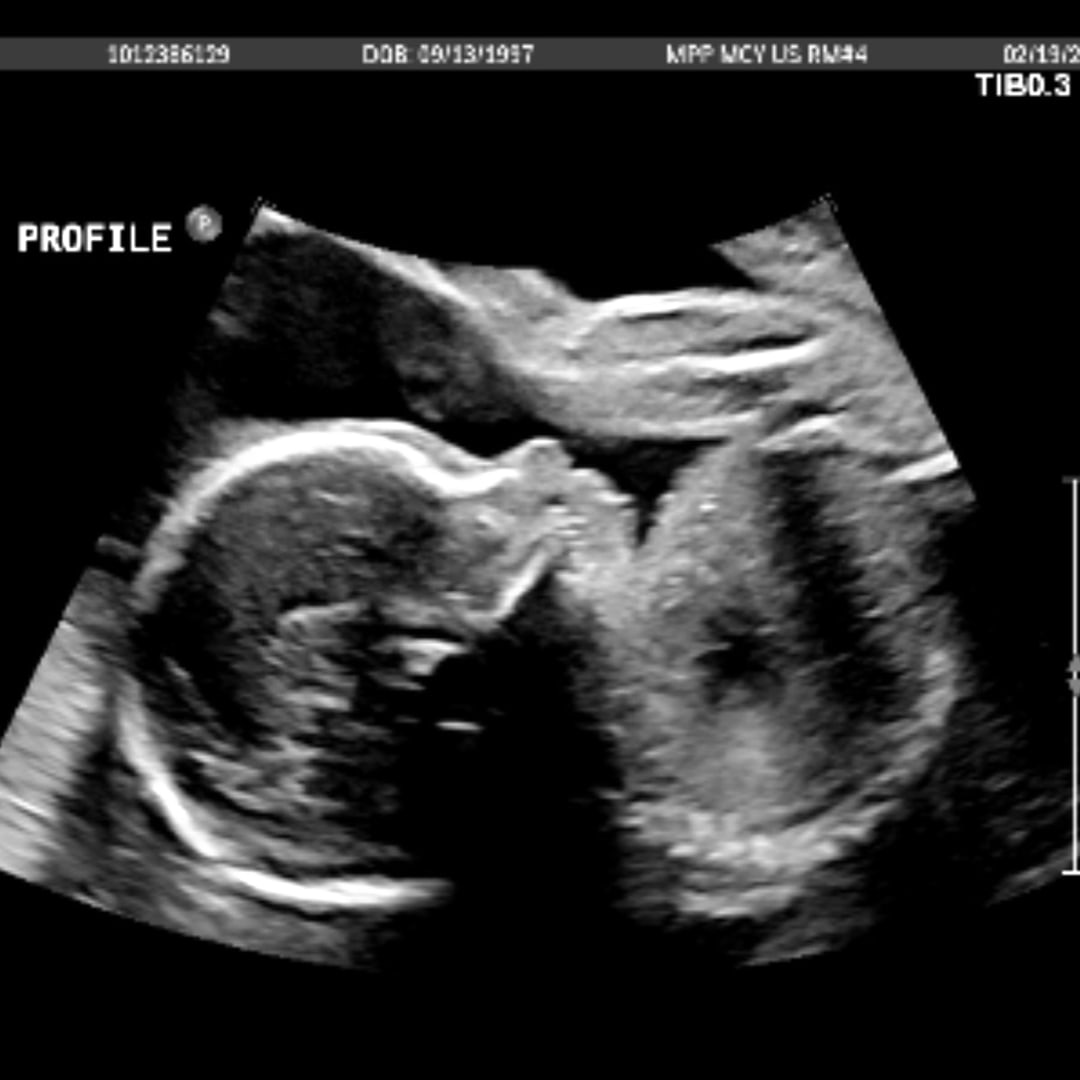 Photo shared by Sara for their Babylist baby registry.