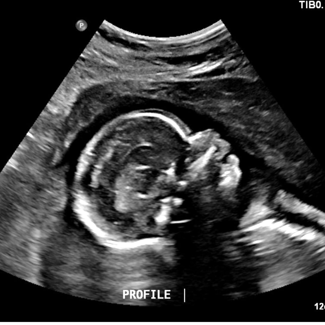 Photo shared by Aspen for their Babylist baby registry.