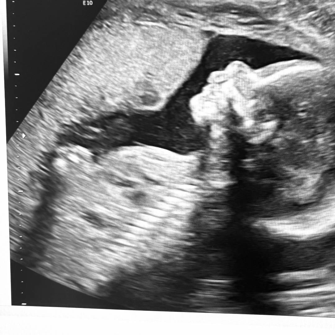 Photo shared by Joy for their Babylist baby registry.